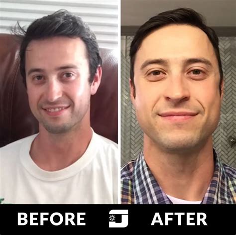 jawzrsize before and after.